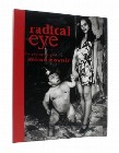 2 x RADICAL EYE